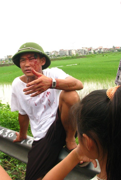 Anh Nguyễn Văn Cường (trú tại xã Liên Bão, Tiên Du) đã bị một số đối tượng đi bên cạnh nhà sư đánh chảy máu đầu.